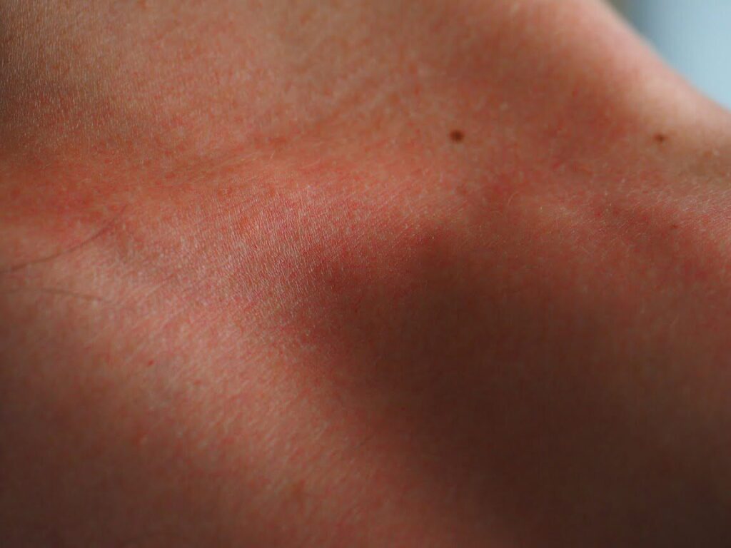 quel visage a l’infection de la peau ? découvrez à travers ces photos explicatives