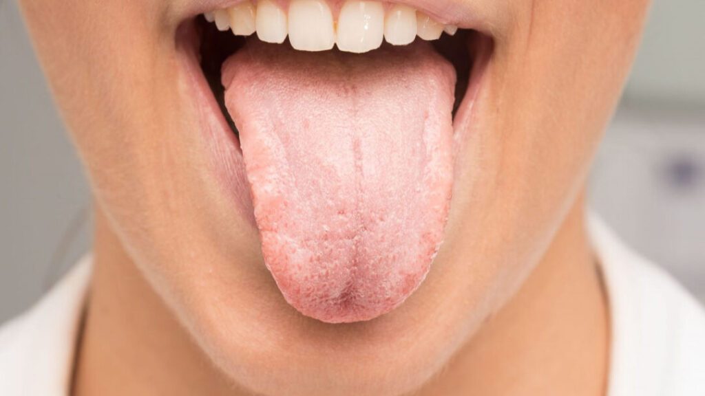 Le nerf glossopharyngien : rôle et troubles associés