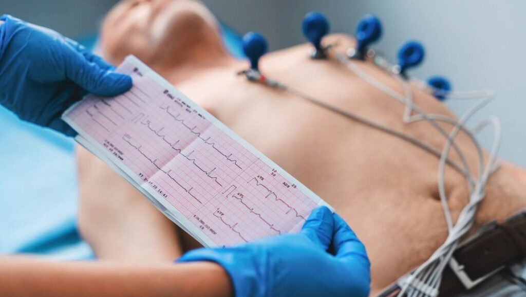 Comprendre les amyloses : symptômes, causes et traitements