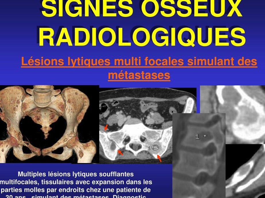 Radiographie du rein: quels enjeux pour votre diagnostic ?