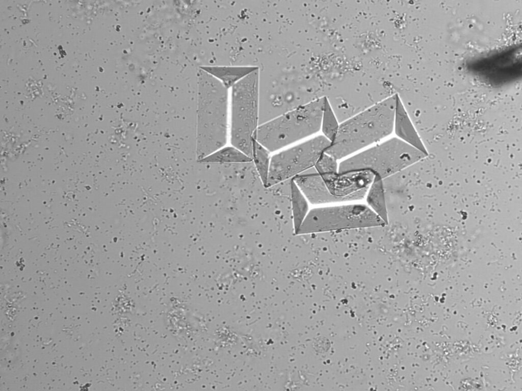 Comment identifier et traiter la formation de cristaux de phosphate de calcium ?