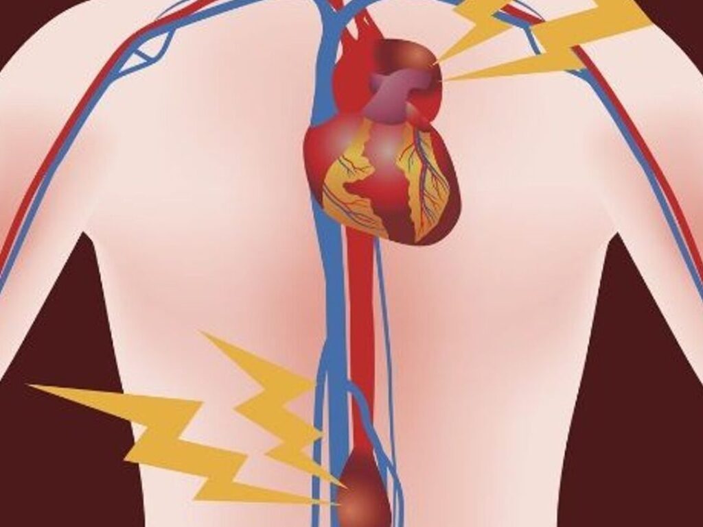 Comprendre les maladies de l’aorte thoracique : signes, symptômes et traitements