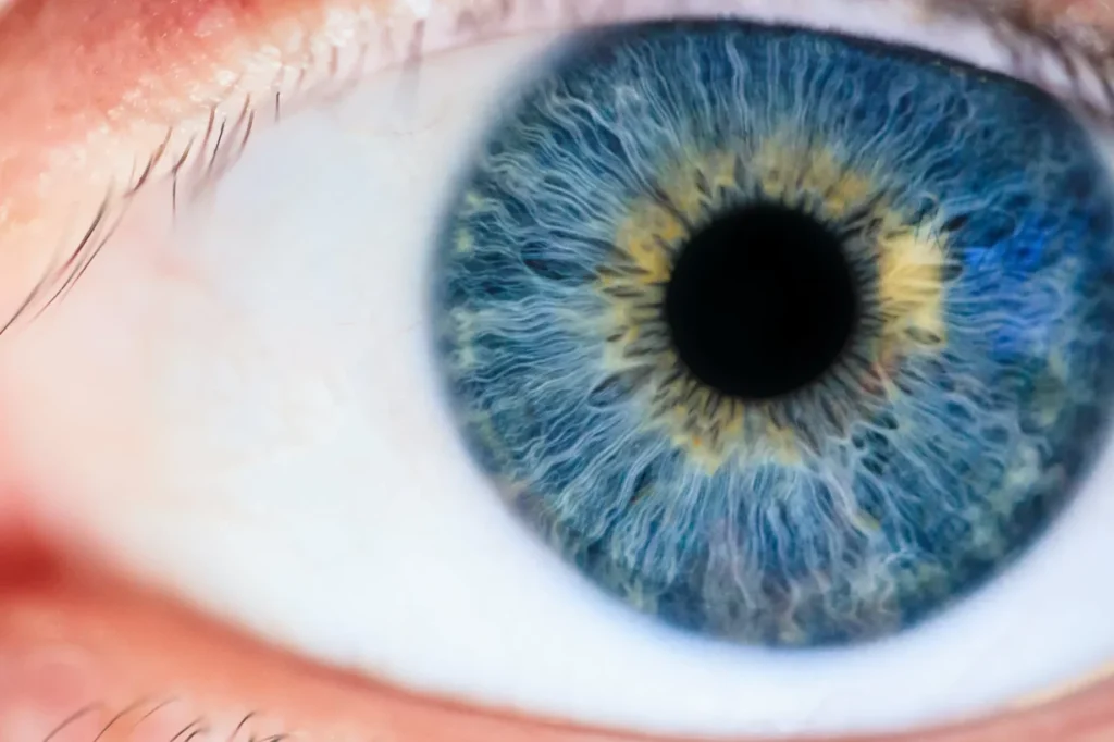 Pourquoi la pupille peut-elle être aréactive à la lumière ?