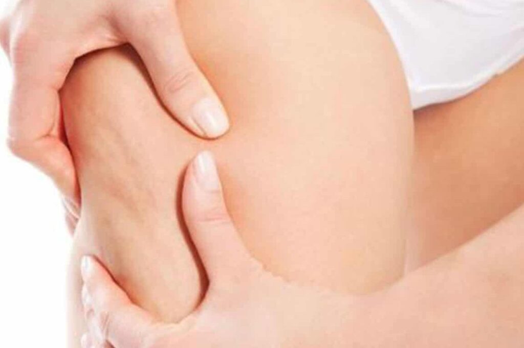 Hypothyroïdie et rétention d’eau : comment gérer ces symptômes connexes ?