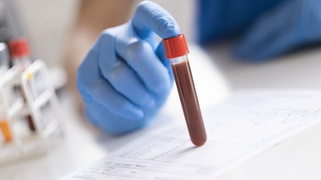 Numération globulaire complète: quels indices pour votre santé ?