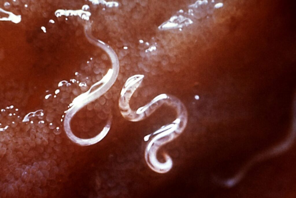 Ancylostoma : tout savoir sur les vers ronds et leurs impacts sur la santé humaine