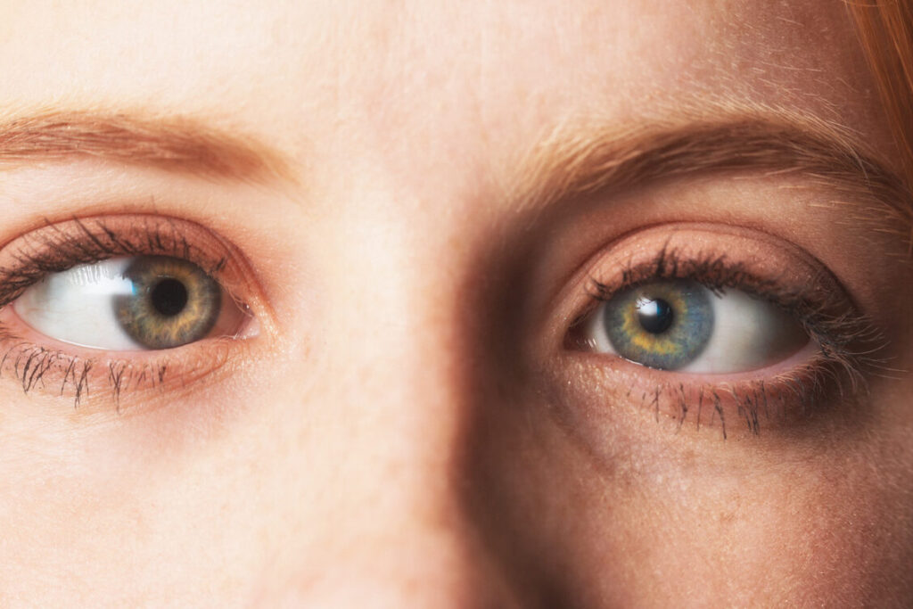 Pourquoi mes yeux louchent-ils ? Causes et traitements du strabisme
