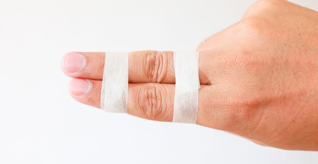 Comment traiter une luxation de la main ?