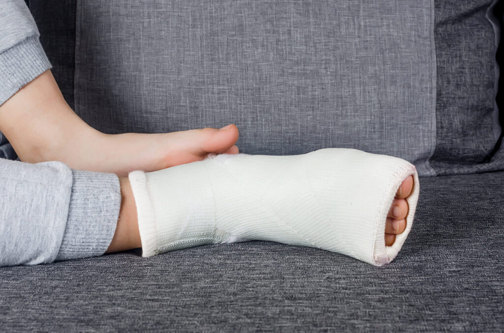 Fracture de Maisonneuve : comment la reconnaître et quel traitement suivre ?