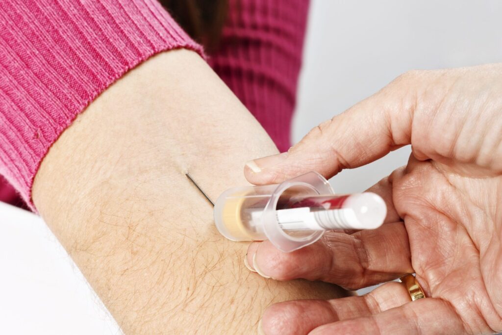 Quels sont les facteurs vitamine K dépendants et leur impact sur votre santé ?