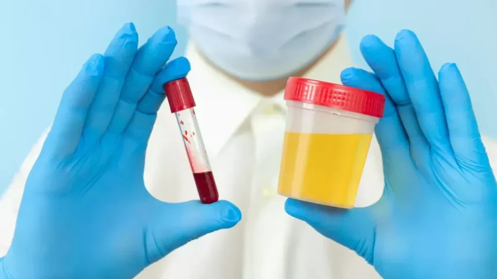 Acth prise de sang : pourquoi cet examen est crucial pour votre santé surrénale ?