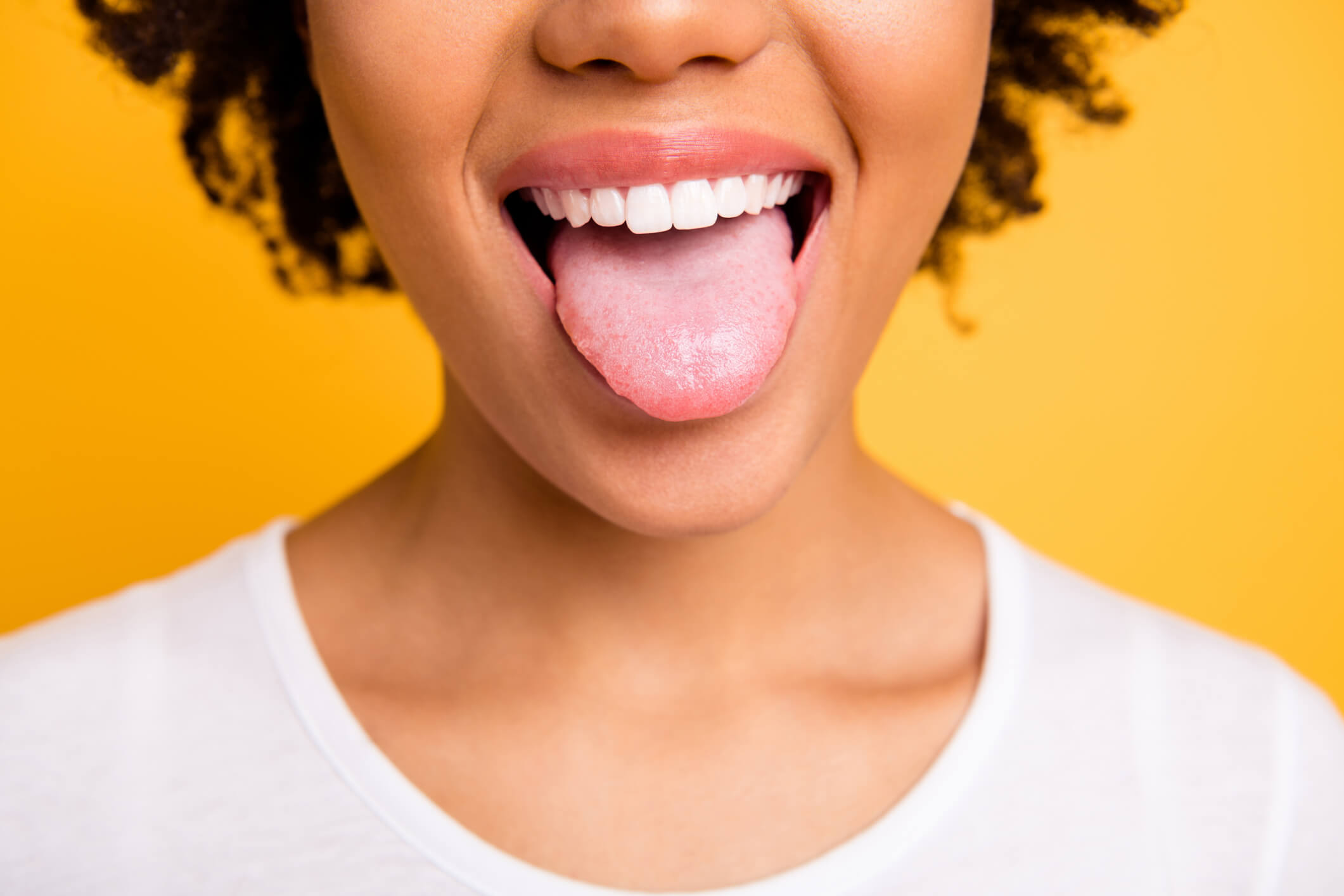 Traitement Fungizone candidose langue