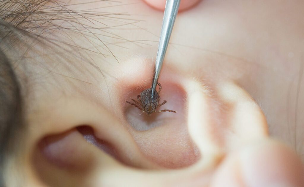Comment réagir si une araignée s&rsquo;est introduite dans votre oreille ?