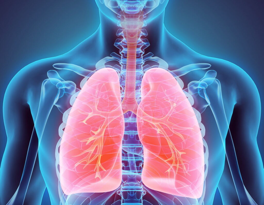 Poumon blanc: qu’est-ce que cela signifie pour votre santé respiratoire?