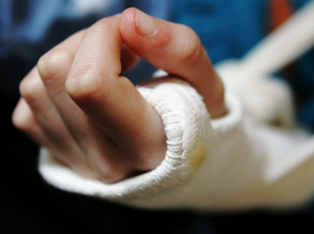 Signes de trousseau : quels sont-ils et que révèlent-ils sur votre santé ?