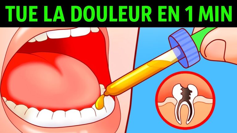 Soulagement rapide d’un mal de dents grâce à des remèdes accessibles sans ordonnance