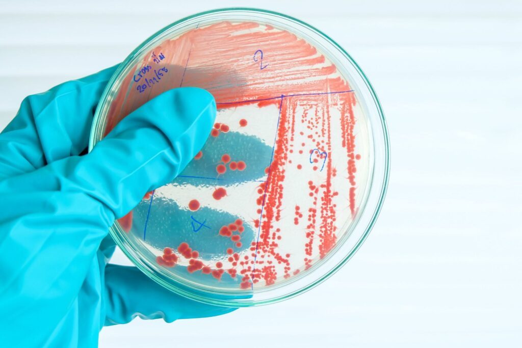 Comment traiter efficacement les infections à mycobactéries ?