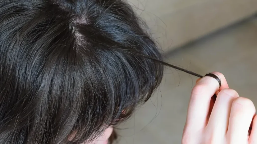 Trichotillomanie : comment mettre fin à cette habitude compulsive ?