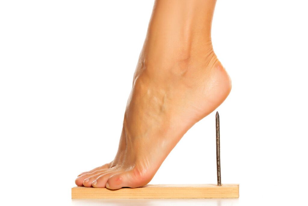Comment soigner naturellement une bursite au pied ?