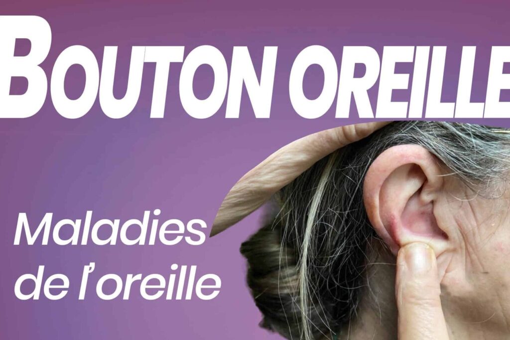 bouton sur le lobe de l’oreille : causes et traitements efficaces