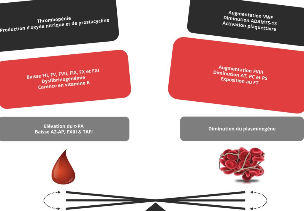 Comprendre le score de Child-Pugh : Quels impacts sur la prise en charge de la cirrhose ?