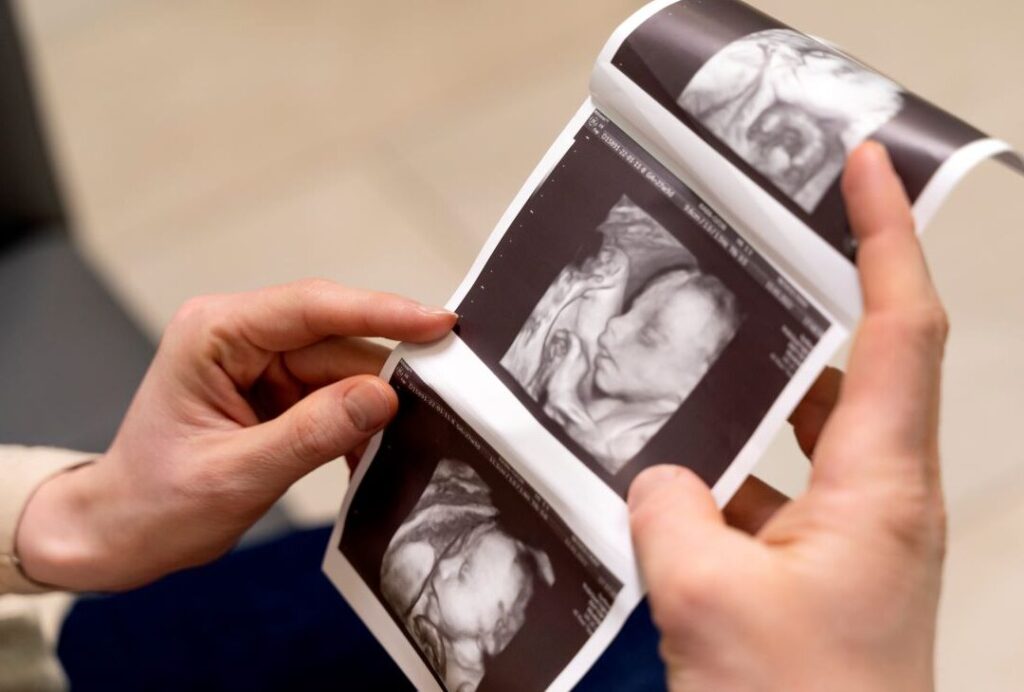 Échographie du 3ème trimestre : que signifie une grosse tête pour mon bébé ?