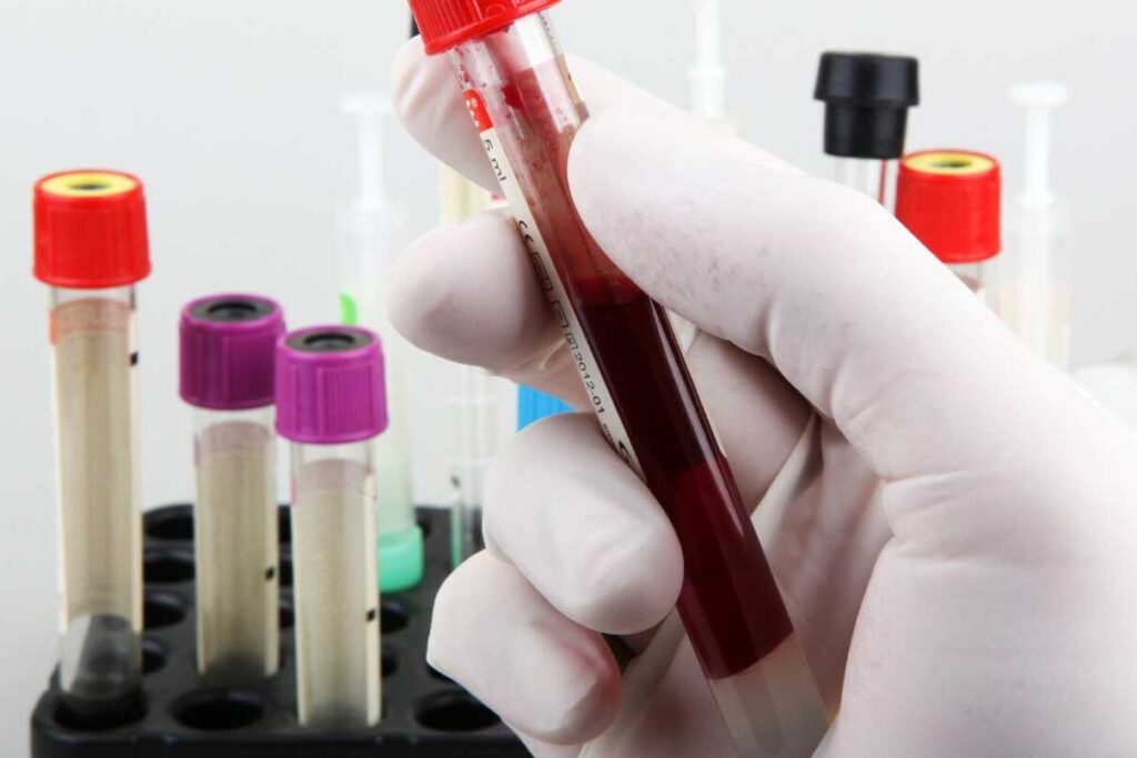 Quelles sont les normes du pH sanguin et pourquoi sont-elles cruciales pour votre santé ?
