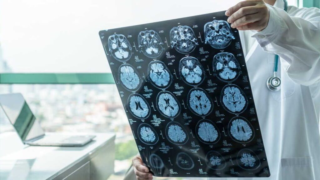 Comprendre l’imagerie posthite : causes, diagnostics et traitements
