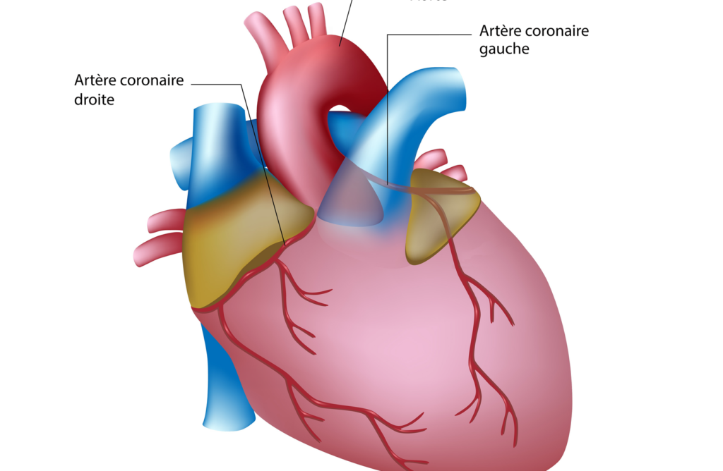 Dissection aortique de type B : quelles sont les perspectives en termes d’espérance de vie ?